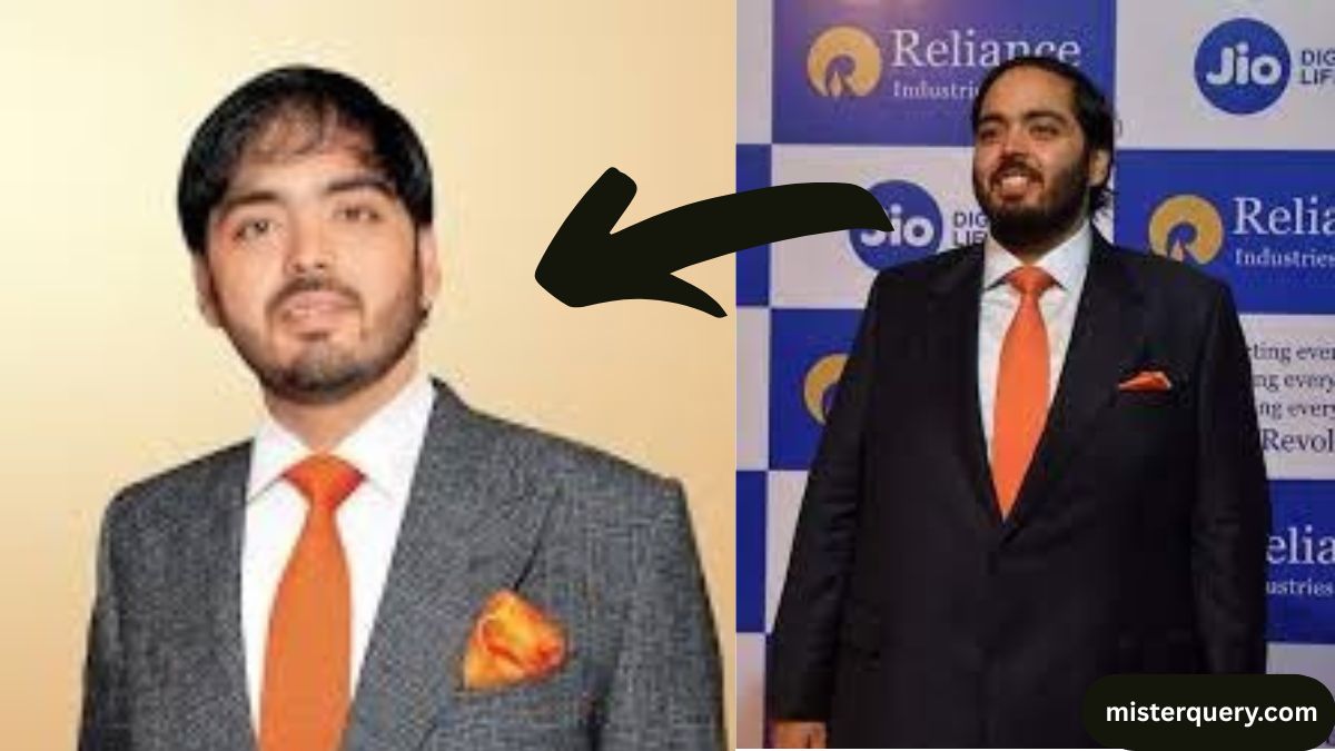 Anant Ambani Weight Loss